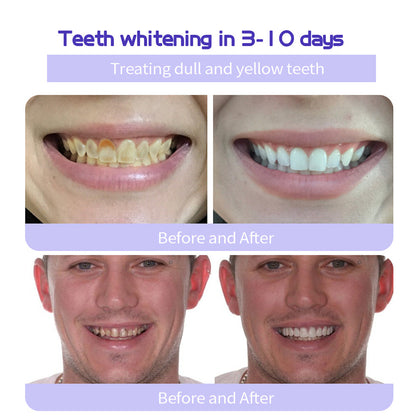 🔥Ends Tonight: Get 60% OFF Before It’s Gone!🎁Fluoride-Free Hydroxyapatite Toothpaste – Gentle Whitening & Enamel Strength for Sensitive Teeth